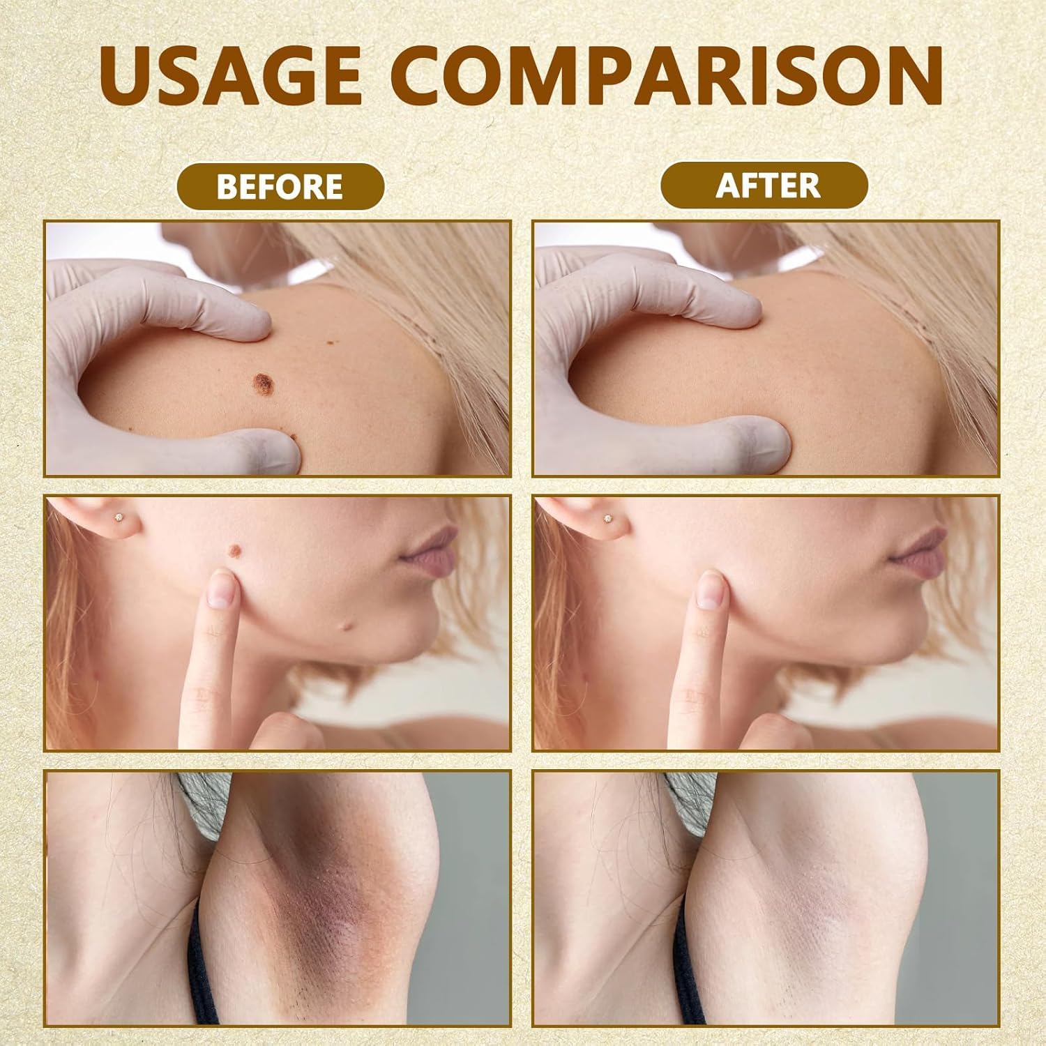 Ylahdent Bee Venom Cream suitable for body care across skin types