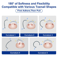 Yanxifei nitinol corrector in use during day-to-day life supports ongoing correction.