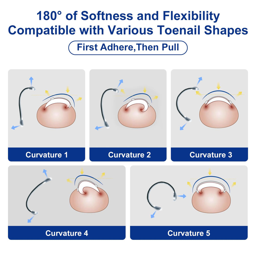 Yanxifei detailed instruction guide — clear steps to perform at-home toenail correction confidently.