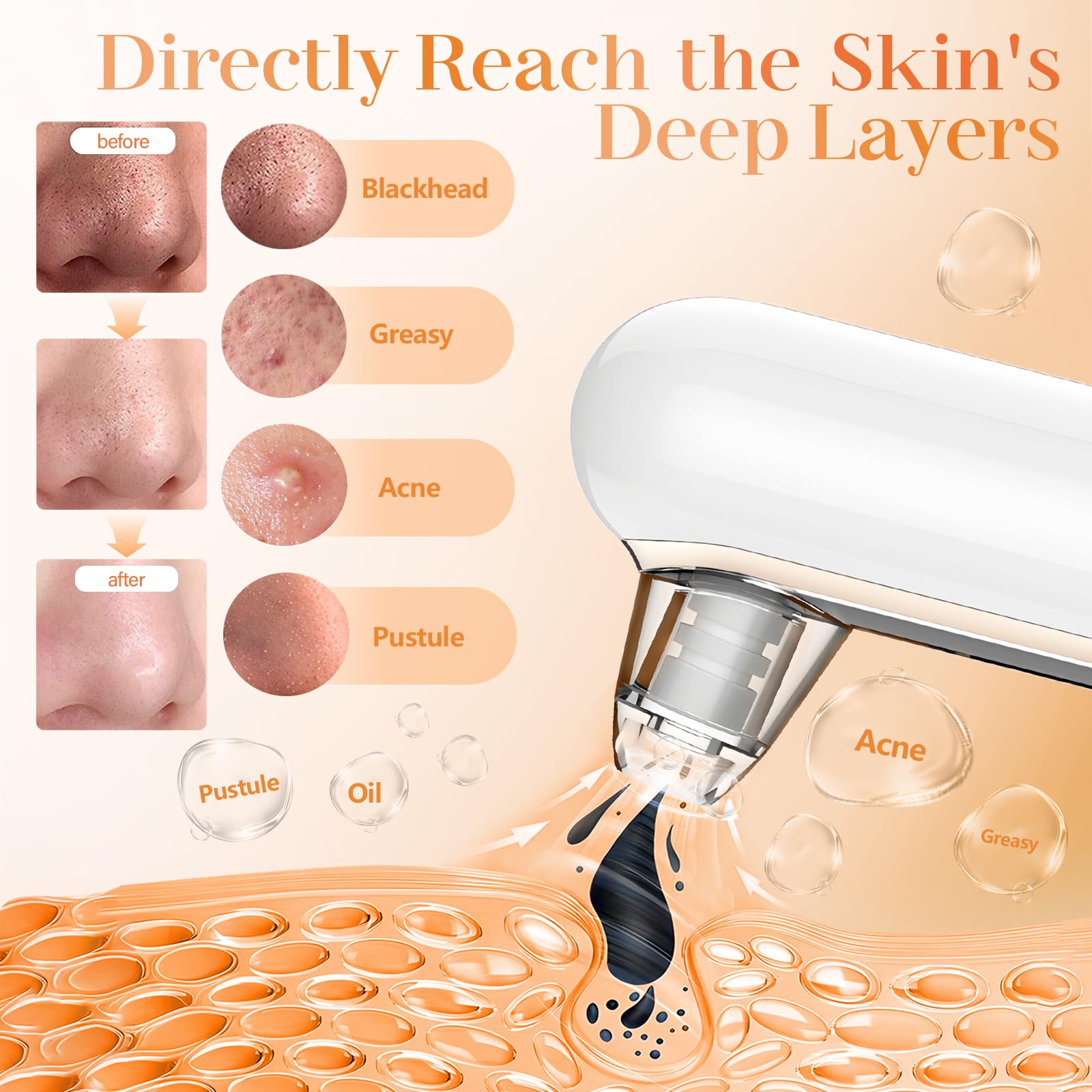 Yccu pore-cleaner suction heads four for targeted extraction across facial zones.