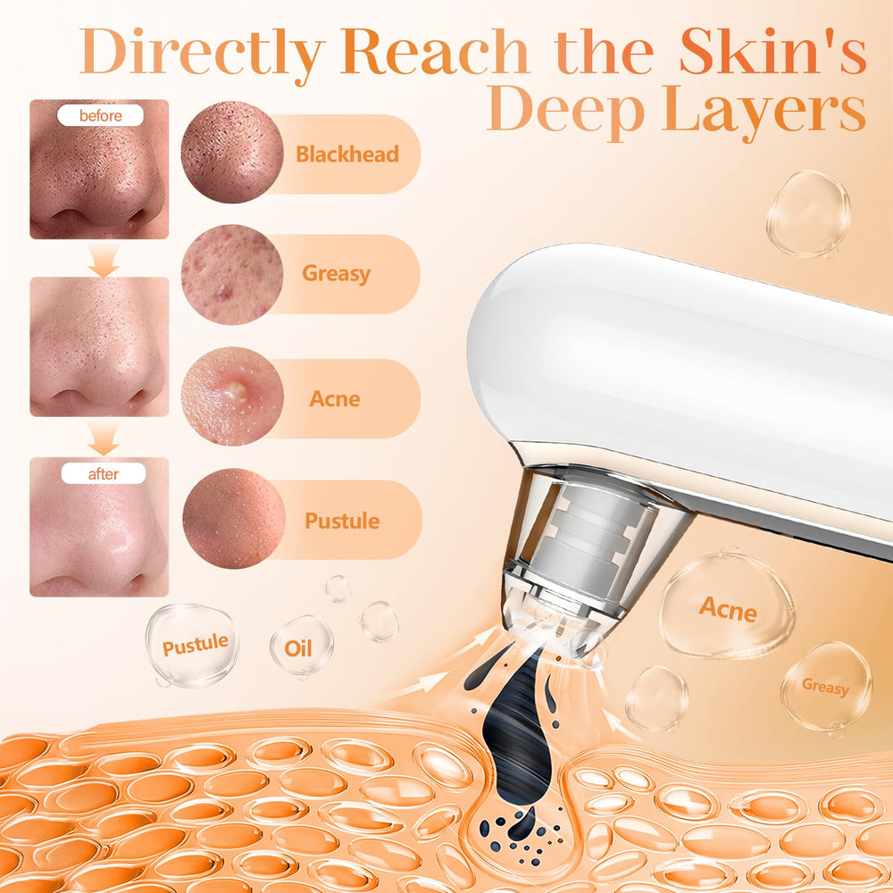 Yccu pore-cleaner suction heads four for targeted extraction across facial zones.