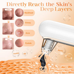 Yccu pore-cleaner suction heads four for targeted extraction across facial zones.