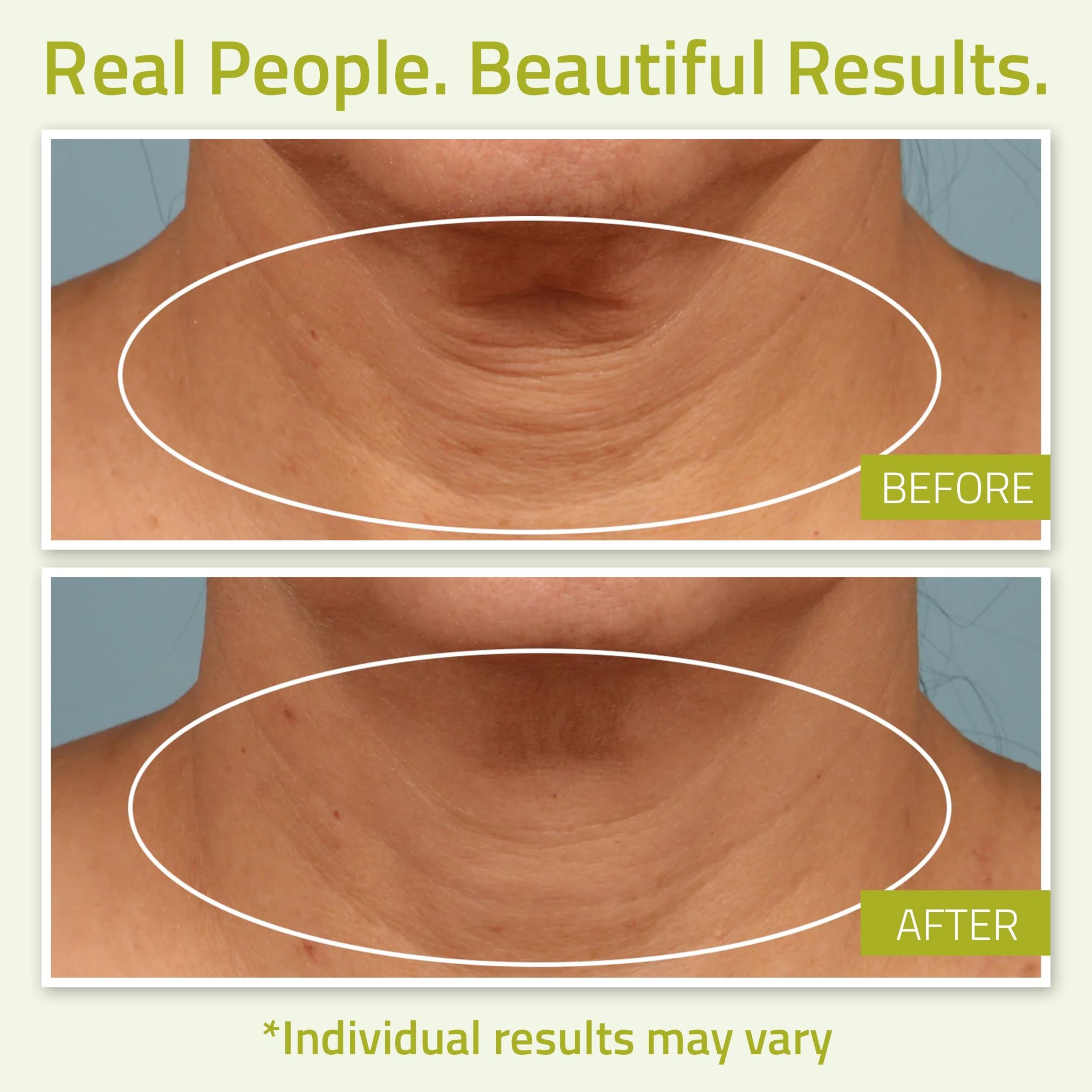 YEOUTH neck cream label closeup highlights clean, paraben-free skincare you can trust.