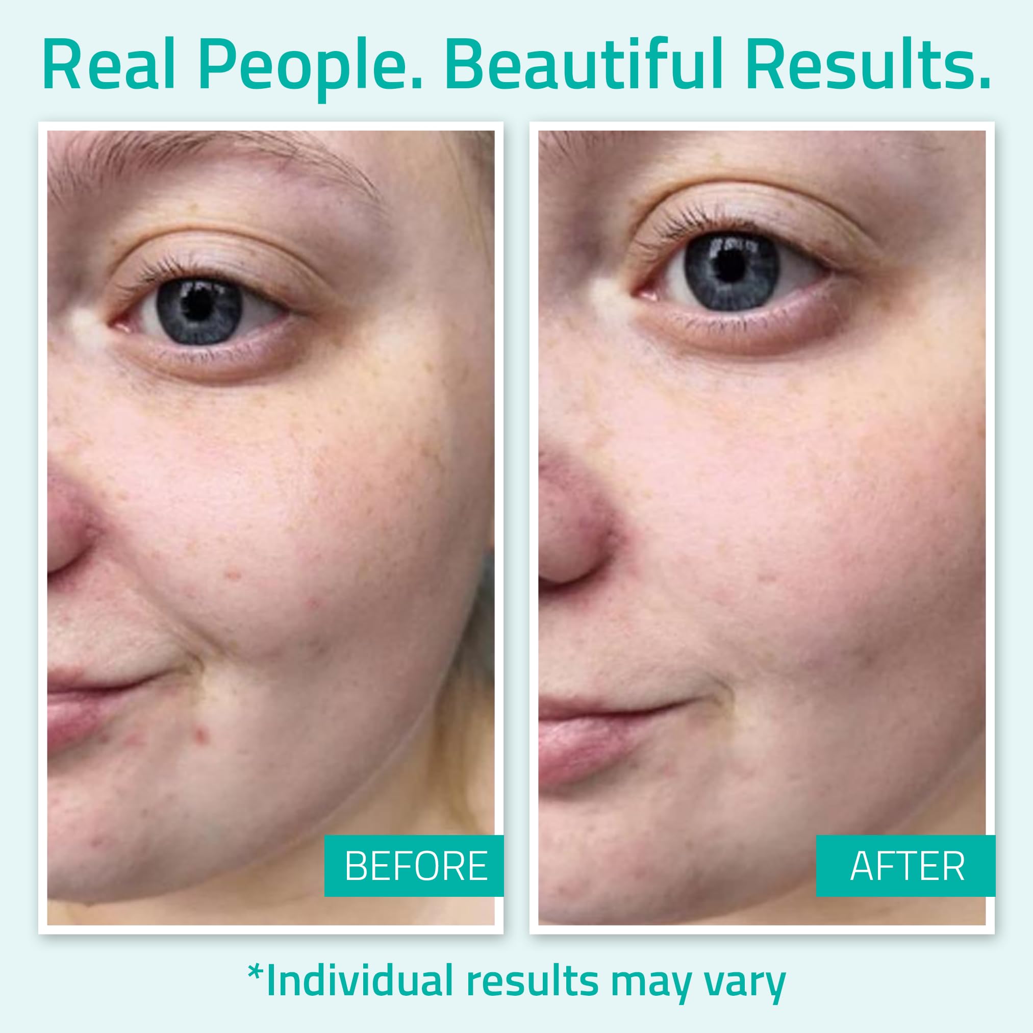 YEOUTH Pure Hyaluronic Acid Serum texture swirl conveys hydration-rich, lightweight consistency.