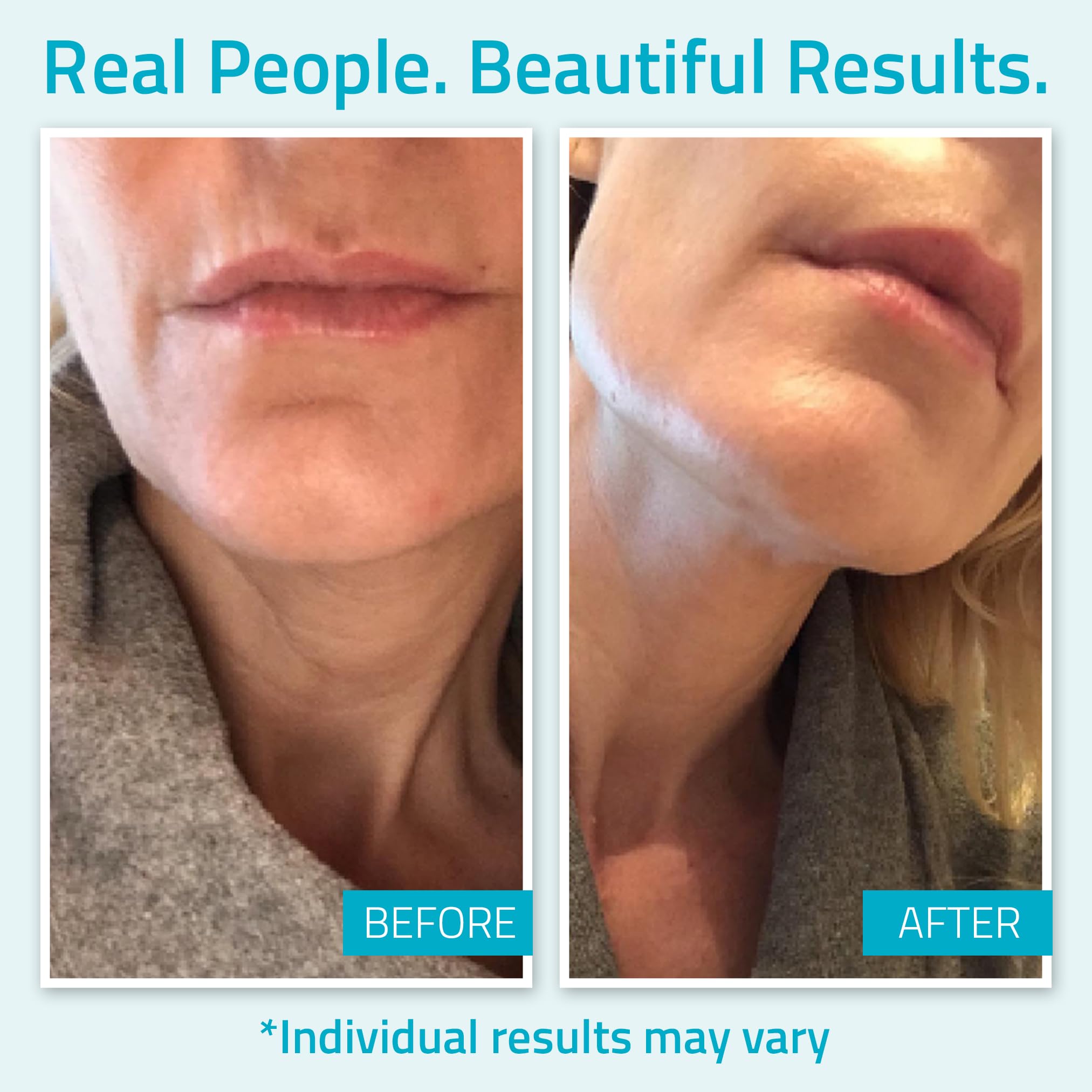 YEOUTH snail mucin ingredient visual highlights skin nourishment and barrier support