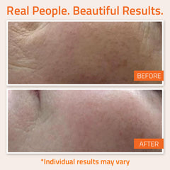YEOUTH Vitamin C serum packaging and label emphasizing clean skincare