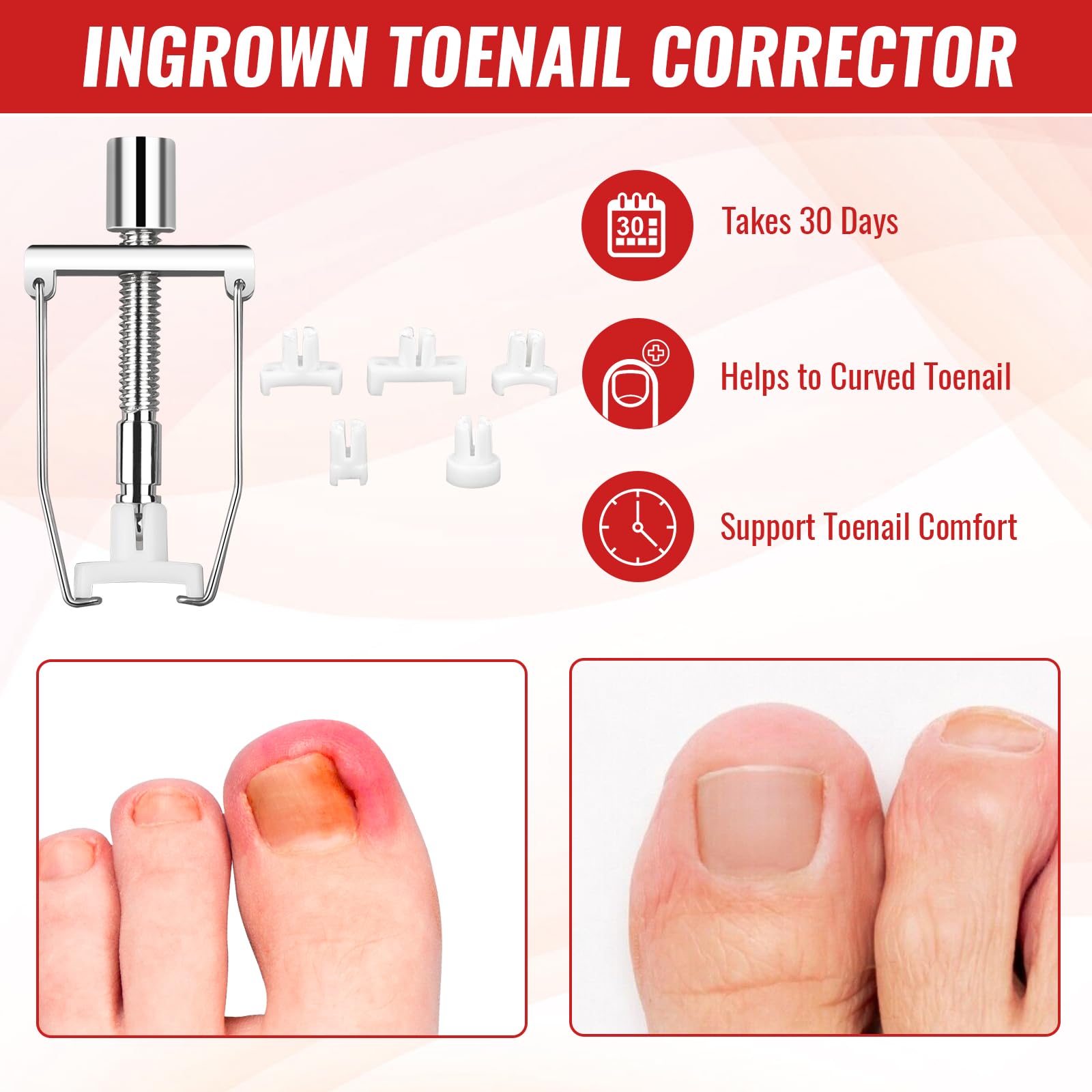YEQOIZ tweezers and clippers enable precise at-home care
