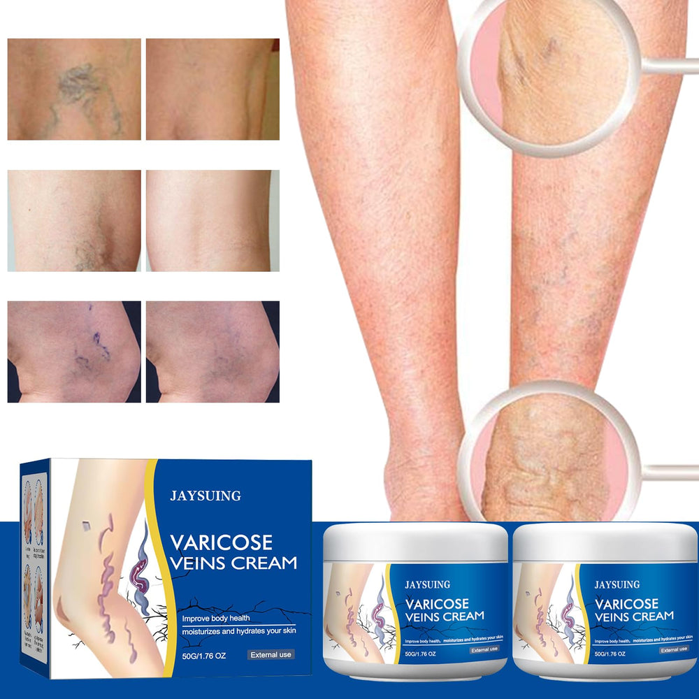 Yetary crema venas varicosas piernas, masaje de abajo hacia arriba para absorción