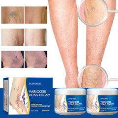 Yetary crema venas varicosas piernas, masaje de abajo hacia arriba para absorción