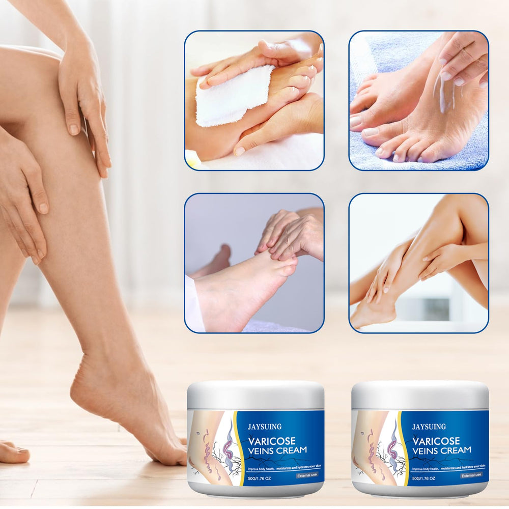 Yetary crema varices apta para pieles sensibles y uso diario