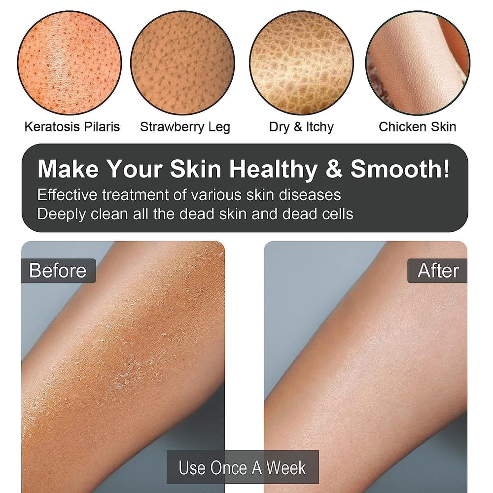 Yiclick exfoliating glove on skin provides a smoother texture.