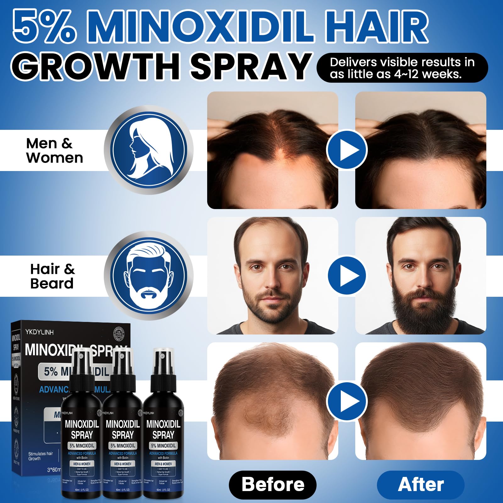 YKDYLINH packaging for minoxidil spray emphasizes convenient daily use