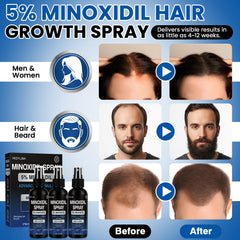 YKDYLINH packaging for minoxidil spray emphasizes convenient daily use