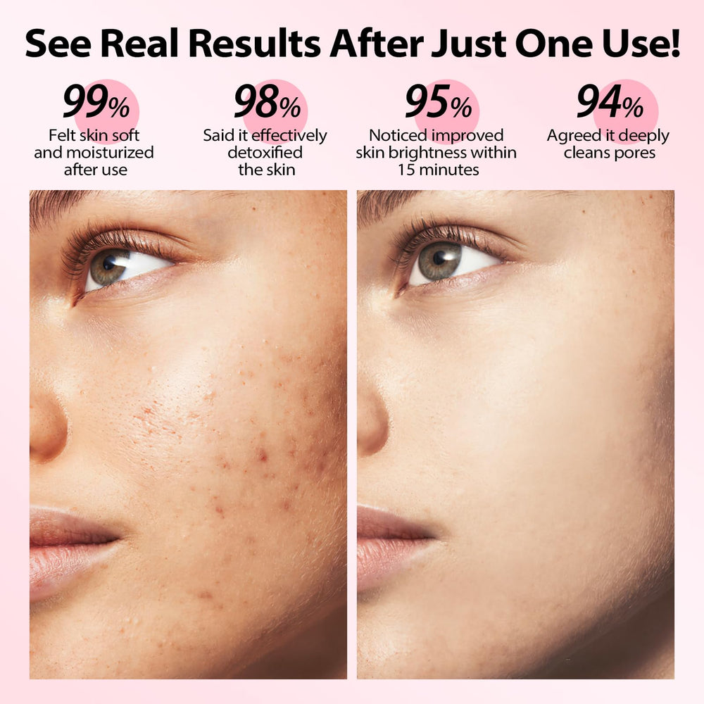 YLNALO Dead Sea mud mask texture reveals mineral-rich cleansing