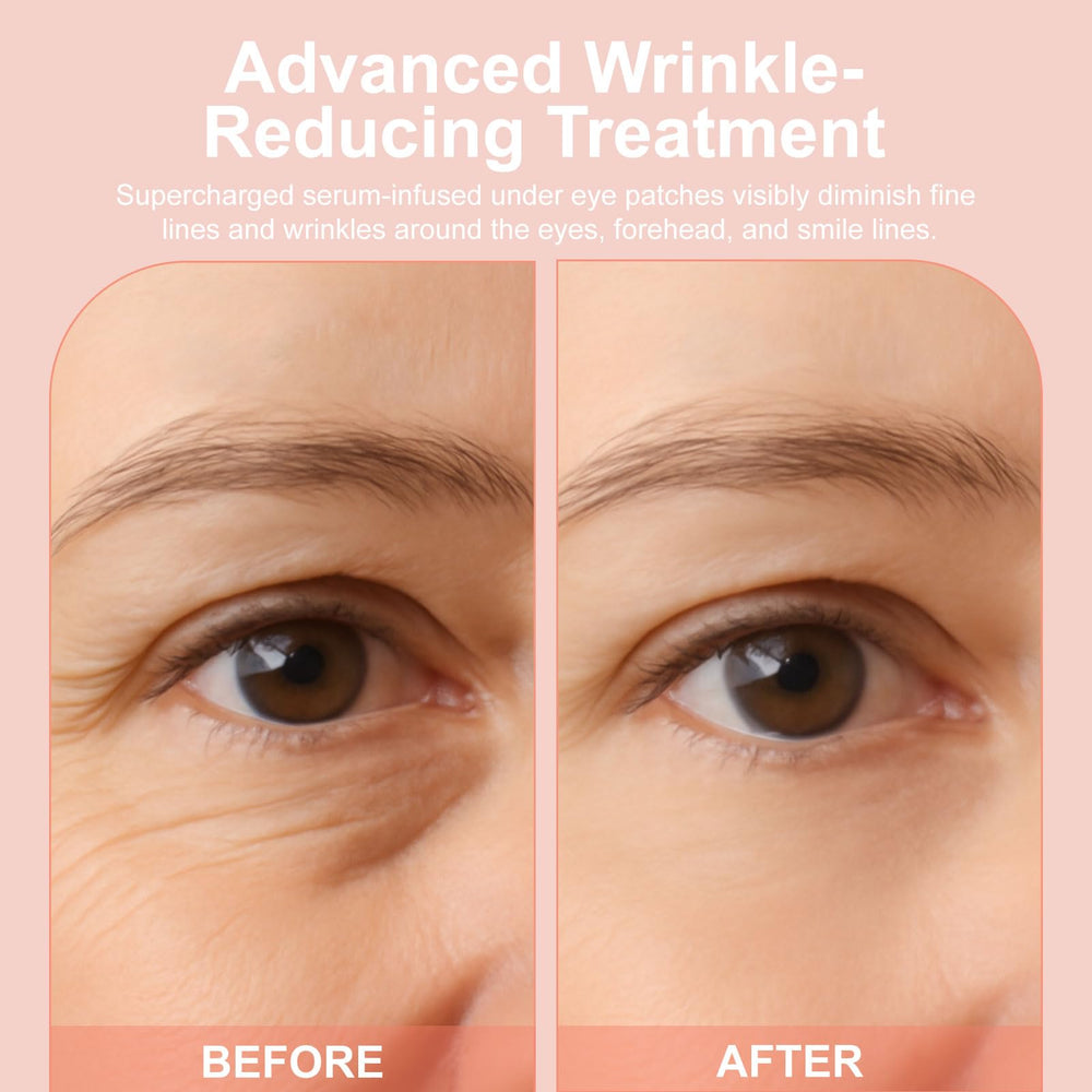 YLOTRE Novalift Micro Eye Patches display deeply hydrating serum on skin.
