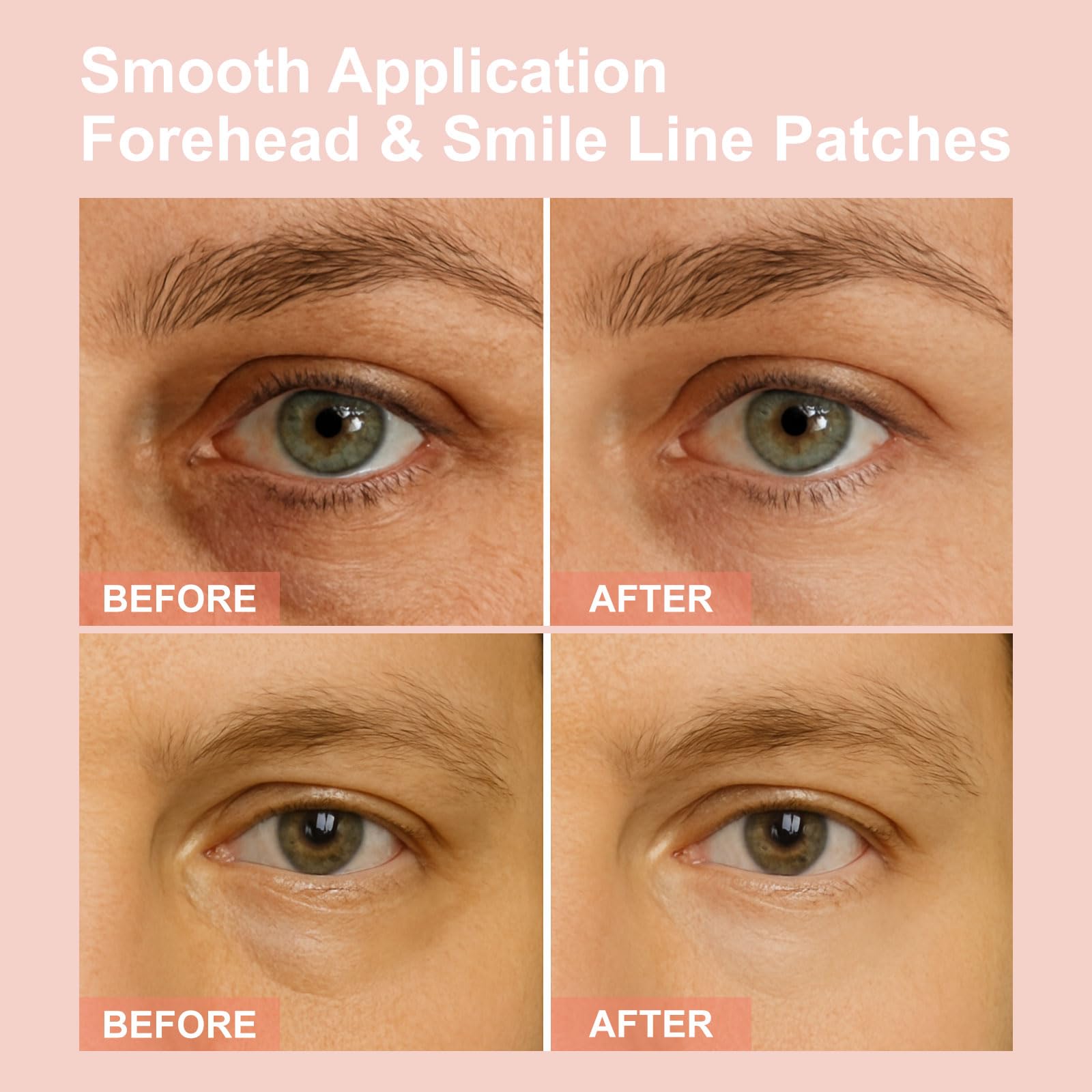 YLOTRE Novalift Micro Eye Patches close-up shows wrinkle-reducing serum effect.