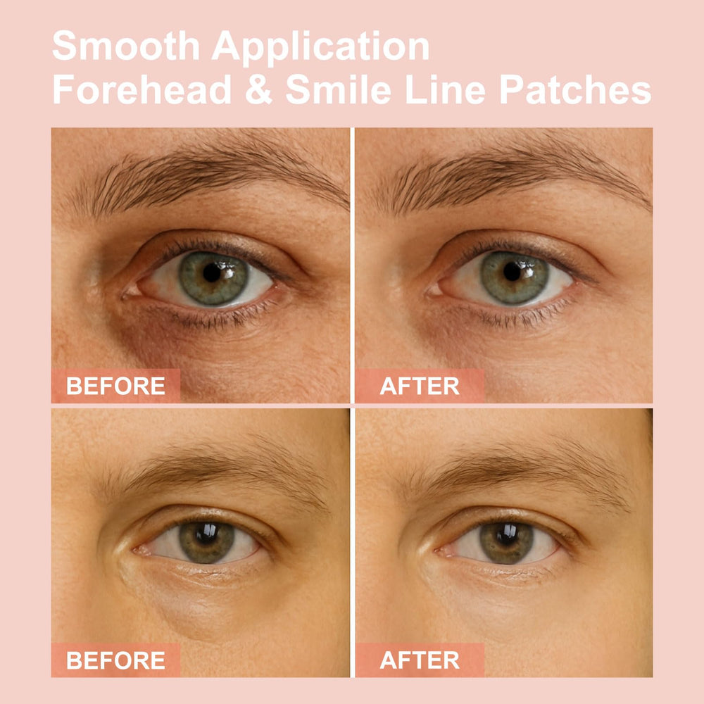 YLOTRE Novalift Micro Eye Patches close-up shows wrinkle-reducing serum effect.