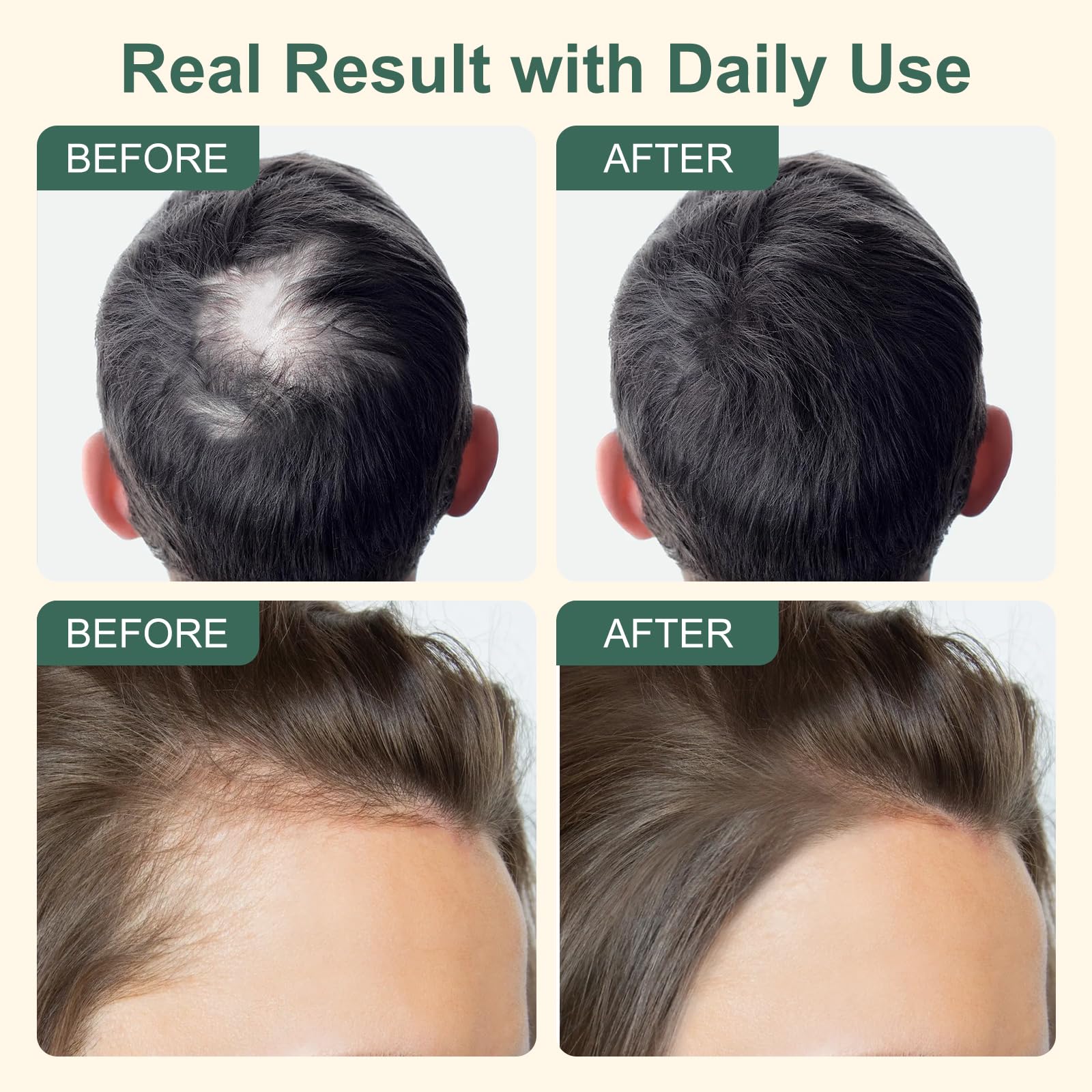 YNGLLC Herbal complex with rosemary, ginger, sage for scalp revitalization.