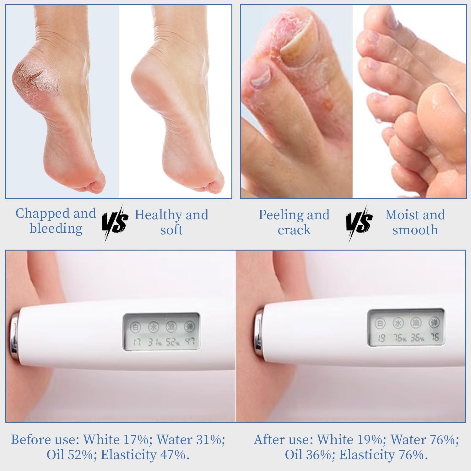 YOUNGYOUNGLOVE Lightweight non-greasy formula leaves feet feeling fresh