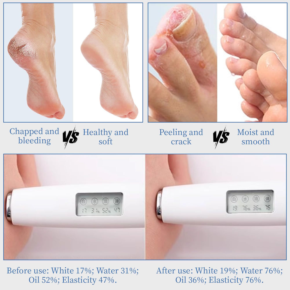 YOUNGYOUNGLOVE Lightweight non-greasy formula leaves feet feeling fresh