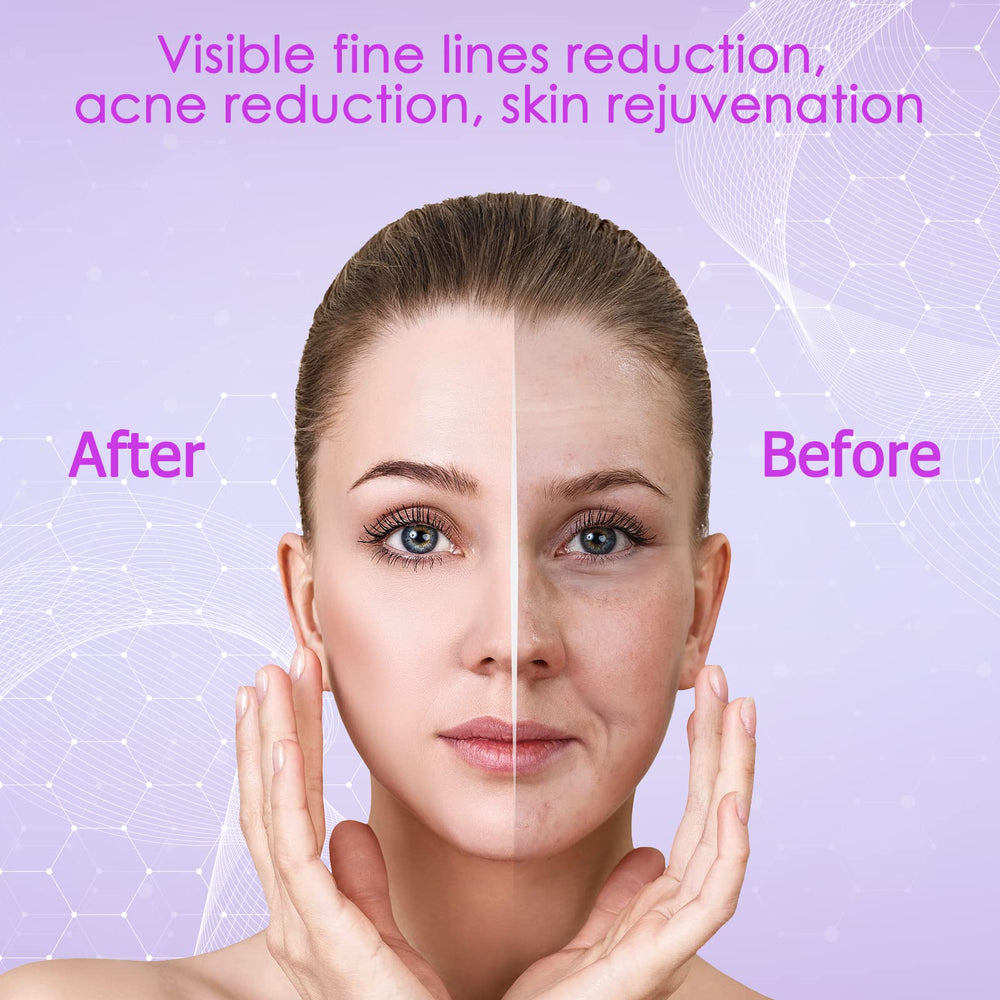 YourMate mushroom tube targets forehead and cheeks for even glow