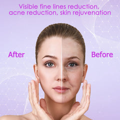 YourMate mushroom tube targets forehead and cheeks for even glow