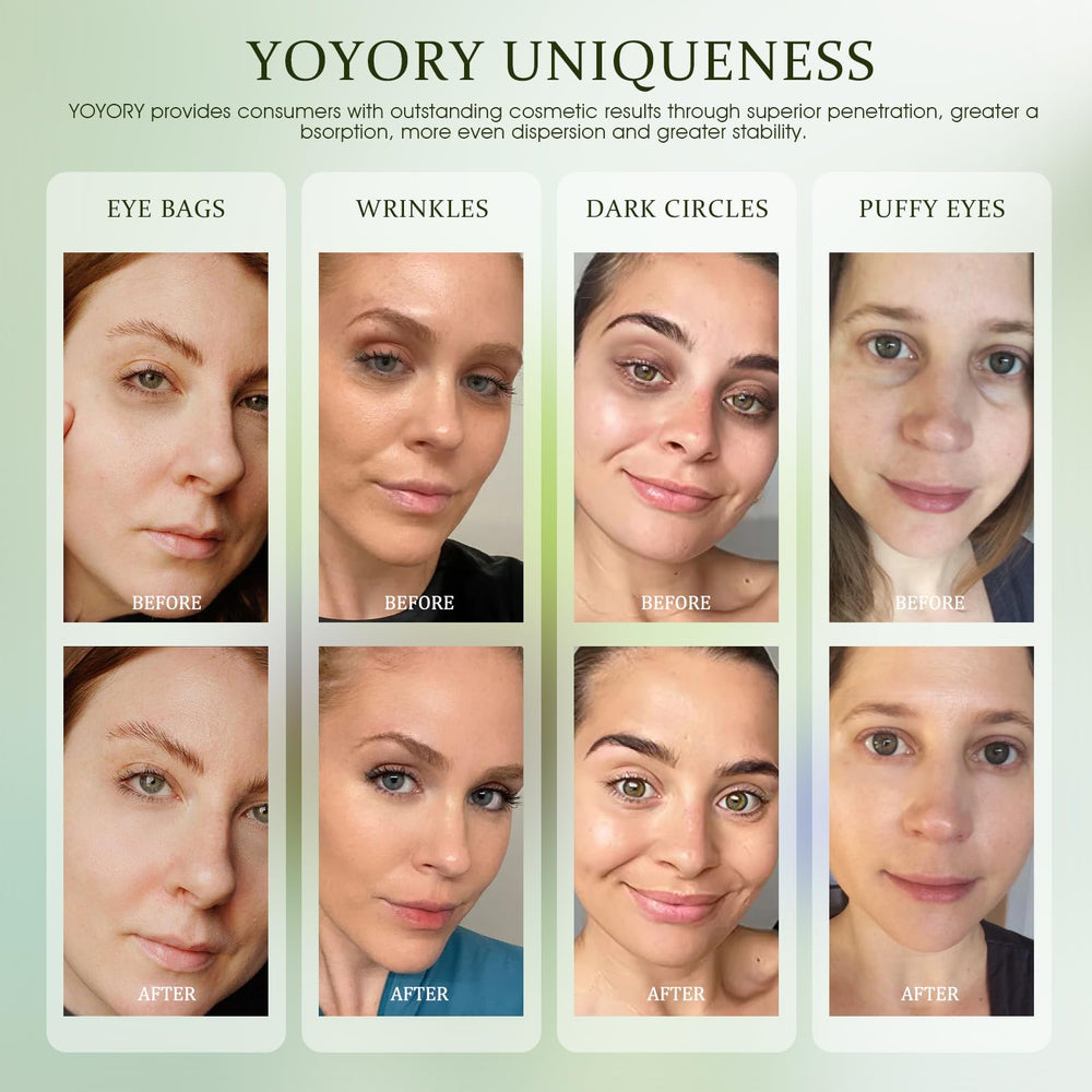 YOYORY collagen eye patches smooth fine lines around the eyes