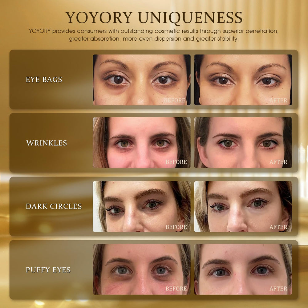 YOYORY hydrogel eye patches in use—micro-molecule slow-release hydration with soothing feel.