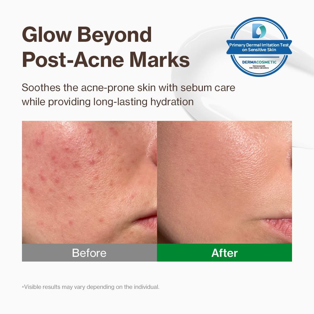 YUMU Cica Exosome Zinc Blemish Relief Cream texture swatch showing lightweight gel-cream feel