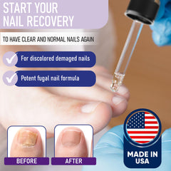 ZanQuick nail recovery packaging 2-pack showing value and ready-to-use routine
