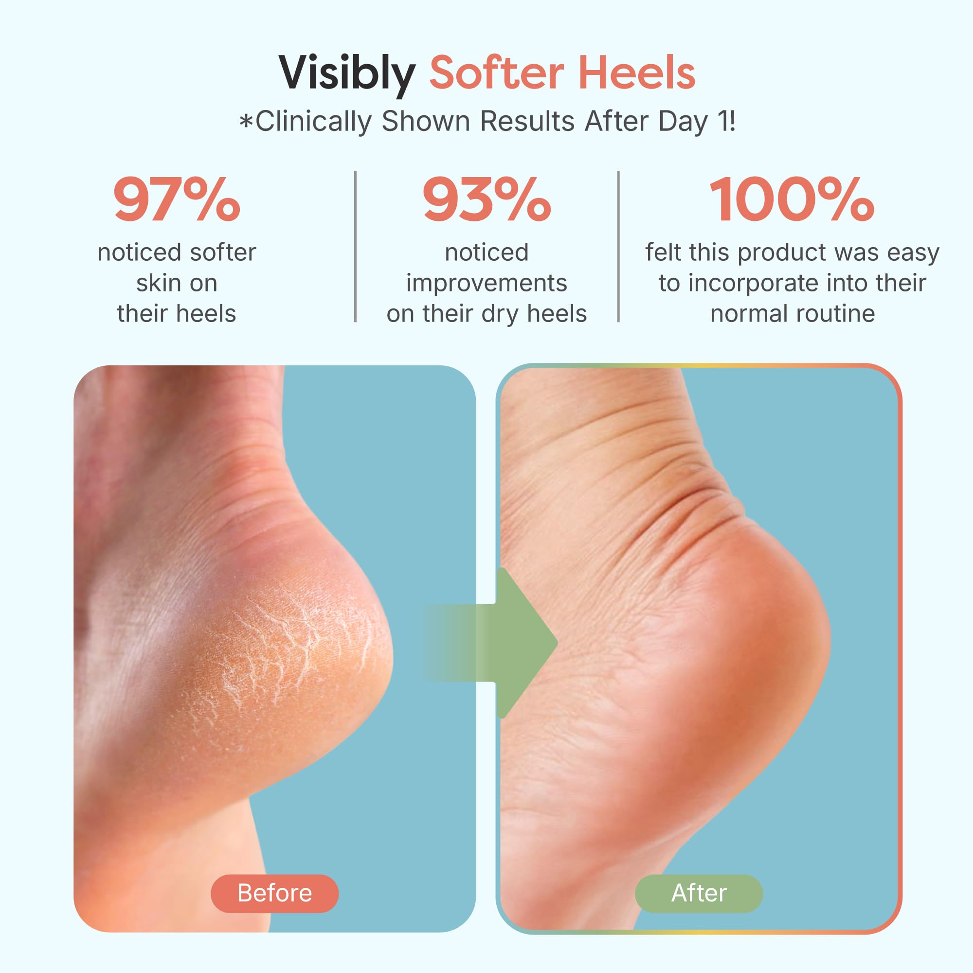 ZenToes night-time pedicure ritual scene promotes relaxing heel care routine.