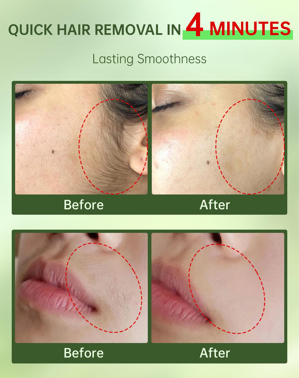 Zeponyx 2-in-1 soothing cream calms sensitive skin after depilation.
