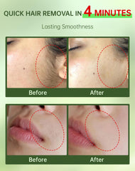 Zeponyx 2-in-1 soothing cream calms sensitive skin after depilation.