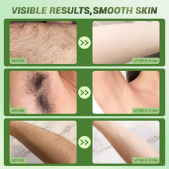Zeponyx Hair Removal Cream for Women underarms use minimizes irritation