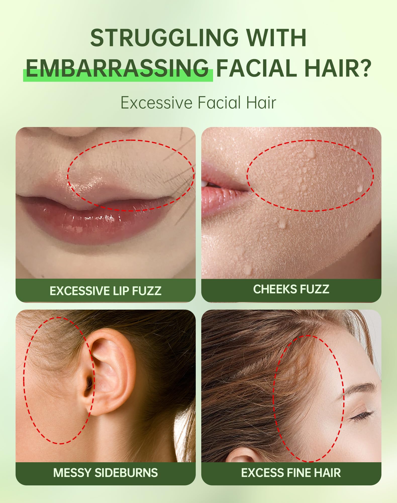Zeponyx chin hair removal for a finer, confident look.