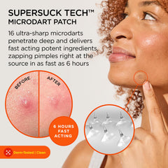 ZitSticka Killa Mini patch on skin demonstrating discreet blemish care in action