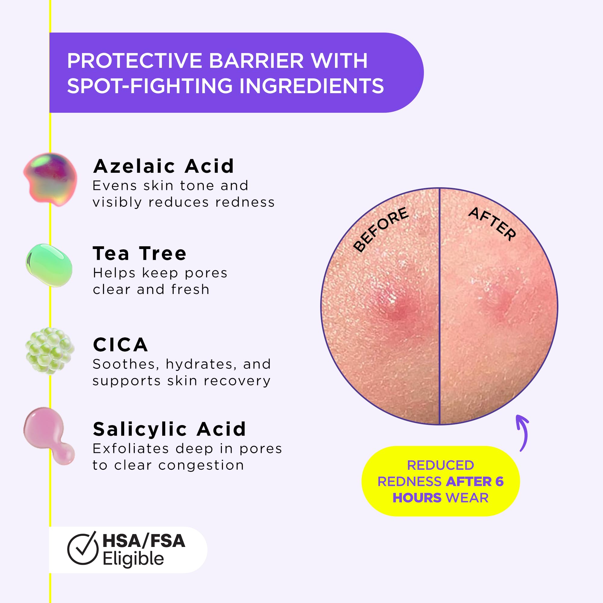 ZitSticka Liquid Patch travel tube for on the go blemish care