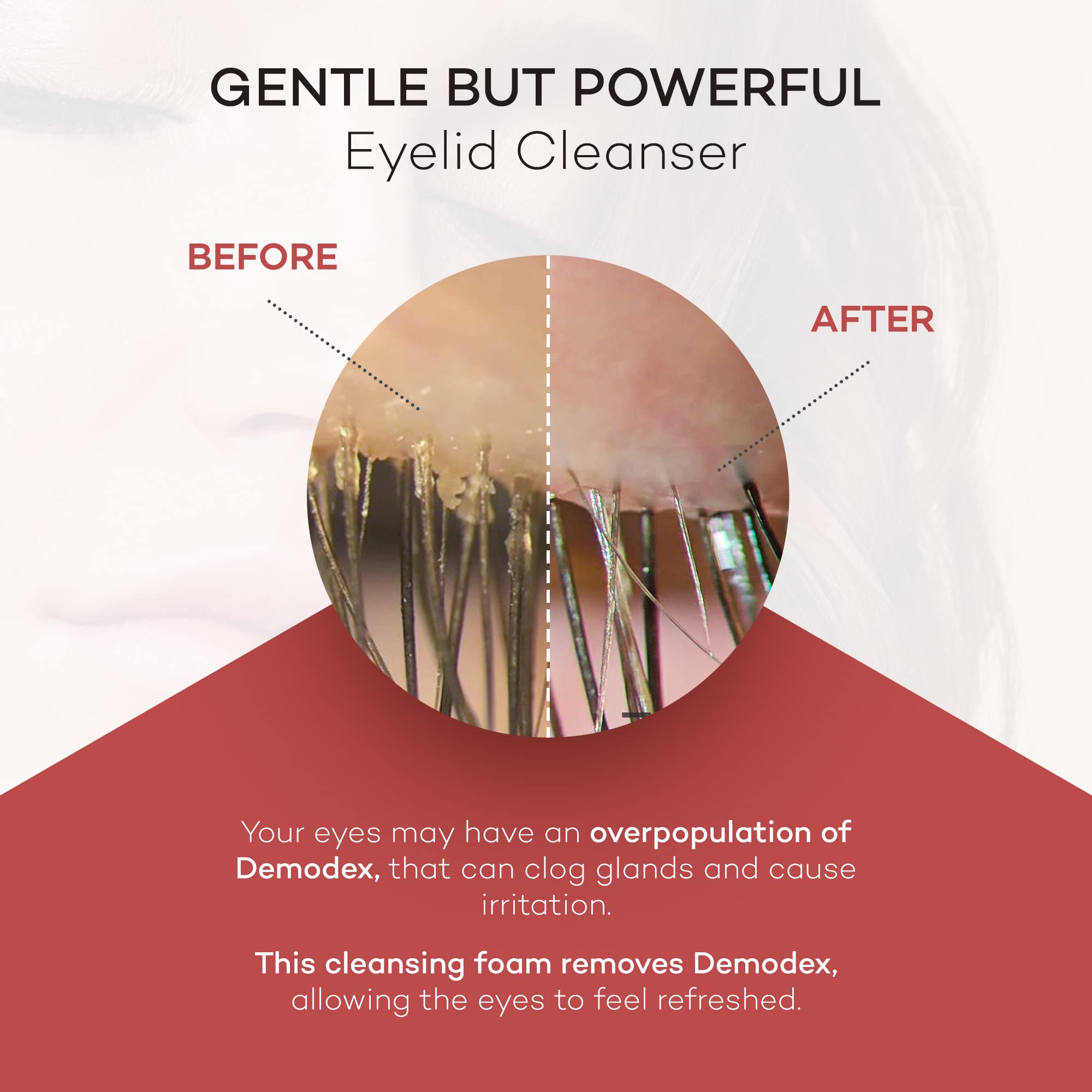 Zocular ZocuFoam eyelid cleanser tube ready to use for refreshed eyelids