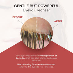 Zocular ZocuFoam eyelid cleanser tube ready to use for refreshed eyelids