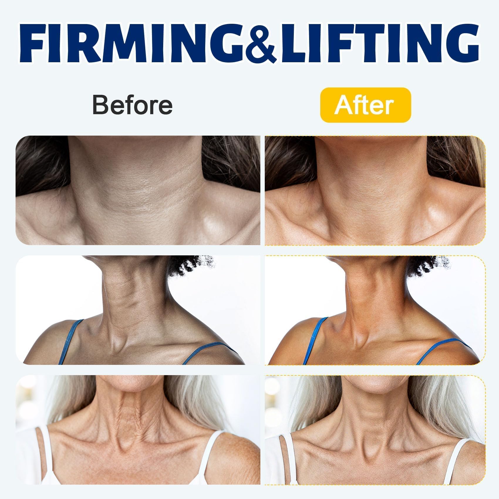 Z:SEA neck-chest firming image demonstrates lifting potential and even tone.