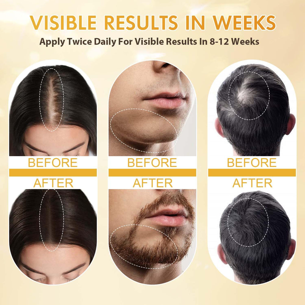 ZYXN Minoxidil daily-use drops emphasize lightweight, non-greasy experience