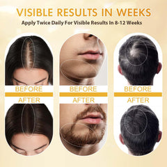 ZYXN Minoxidil daily-use drops emphasize lightweight, non-greasy experience
