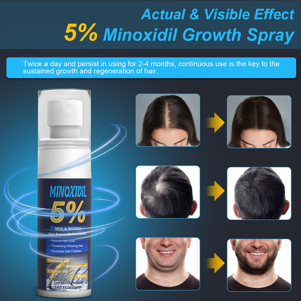 ZYXN rosemary-infused formula bottle highlighting herbal blend for follicle-friendly support.