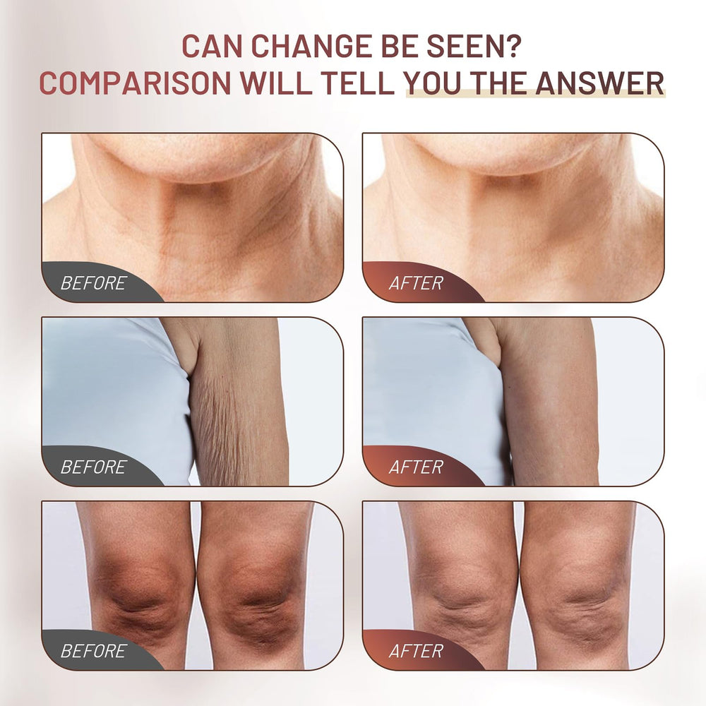 ZZILME Crepe Fix on face and neck demonstrates targeted tightening