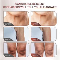 ZZILME Crepe Fix on face and neck demonstrates targeted tightening